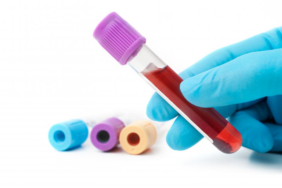 Сдать общий анализ крови ребенка в ростове thumbnail
